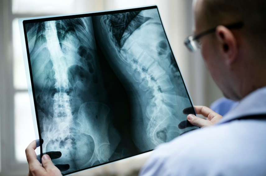 doctor looking at x-ray image